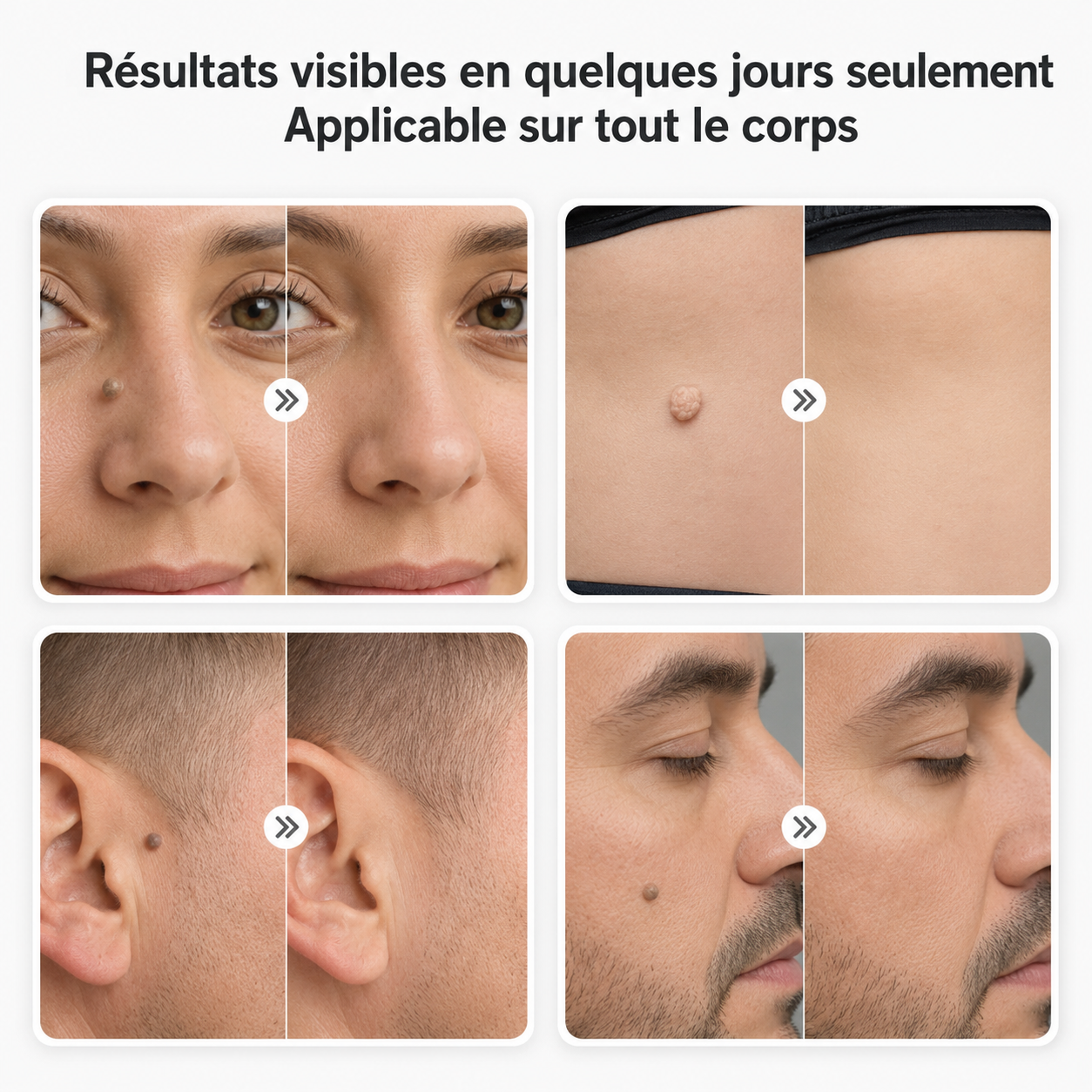 Lomuria DermoPatch™