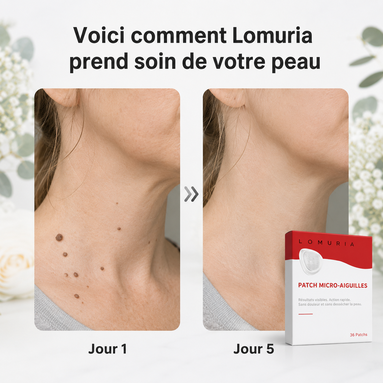 Lomuria DermoPatch™